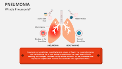 What is Pneumonia? - Slide 1
