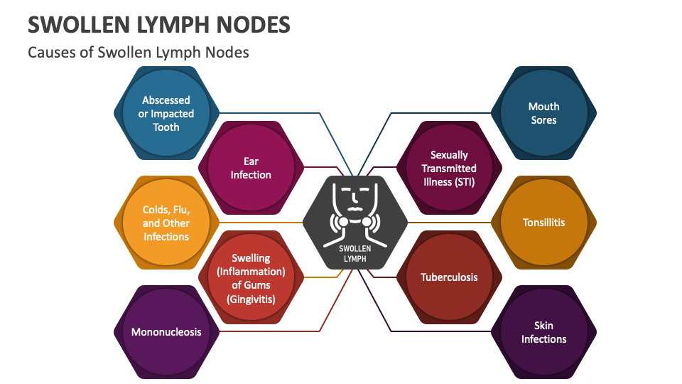 Swollen Lymph Nodes Powerpoint And Google Slides Template Ppt Slides Swollen Lymph Nodes Powerpoint And Google Slides Template Ppt Slides