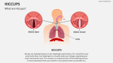 What are Hiccups? - Slide 2