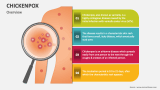 Overview of Chickenpox - Slide 2
