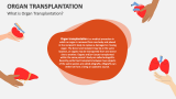 What is Organ Transplantation? - Slide 2
