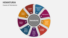 Causes of Hematuria - Slide 1