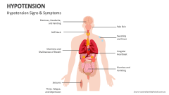 Hypotension Signs & Symptoms - Slide 1