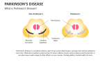 What is Parkinson's Disease? - Slide 2