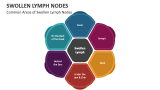 Common Areas of Swollen Lymph Nodes - Slide 2