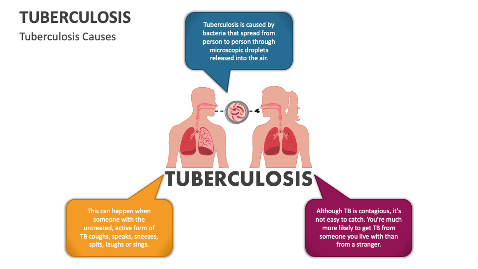Tuberculosis powerpoint and google slides template ppt slides