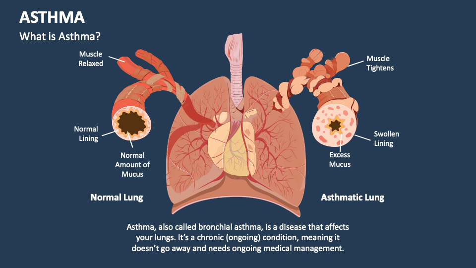 asthma-powerpoint-and-google-slides-template-ppt-slides