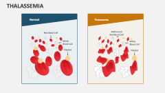 Thalassemia - Slide 1