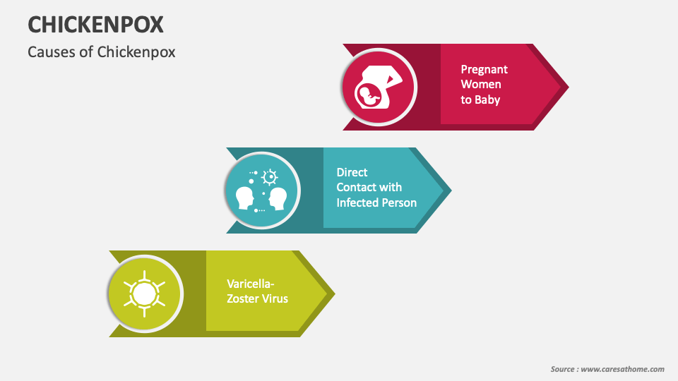 Chickenpox PowerPoint and Google Slides Template - PPT Slides