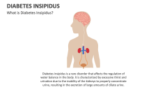 What is Diabetes Insipidus? - Slide 1