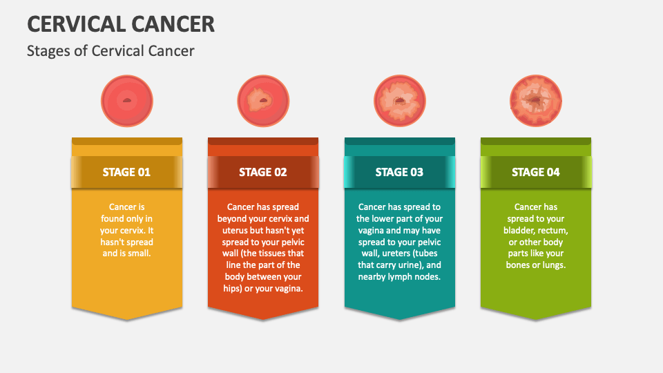 Cervical Cancer PowerPoint and Google Slides Template PPT Slides