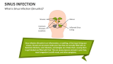 What is Sinus Infection (Sinusitis)? - Slide 1