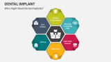 Who might Need Dental Implants? - Slide 4