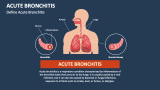 Define Acute Bronchitis - Slide 1