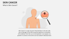 What is Skin Cancer? - Slide 1