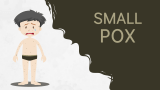 Smallpox - Slide 1