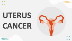 Uterus Cancer - Slide 1
