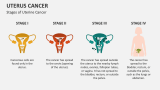Stages of Uterine Cancer - Slide 3