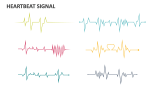 Heartbeat Signal - Slide 1