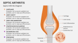 Septic Arthritis Diagram - Slide 3