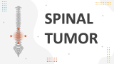 Spinal Tumor - Slide 1
