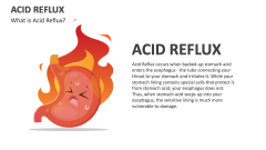 What is Acid Reflux? - Slide 1