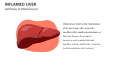 Definition of Inflamed Liver - Slide 1