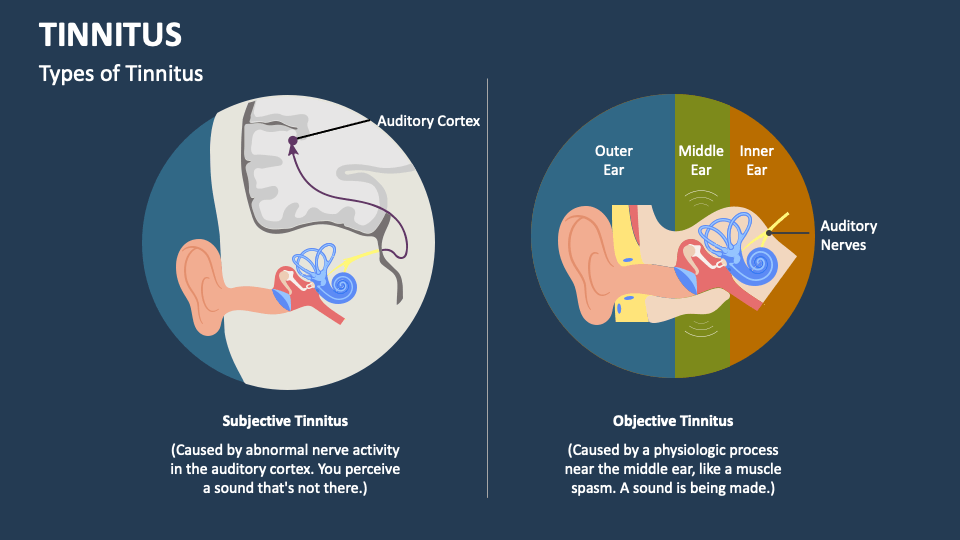 Tinnitus powerpoint and google slides template ppt slides
