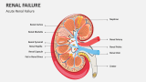 Acute Renal Failure - Slide 2
