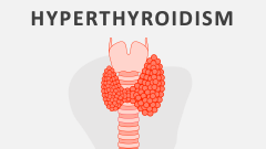 Hyperthyroidism - Slide 1