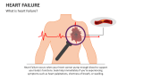 What is heart Failure? - Slide 1