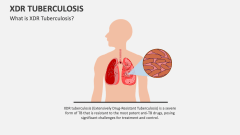 XDR Tuberculosis - Slide 1