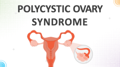 Polycystic Ovary Syndrome - Slide 1