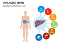 Symptoms of Inflamed Liver - Slide 2