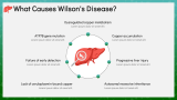 Wilson's Disease - Slide 5