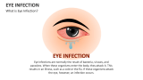 What is Eye Infection? - Slide 1
