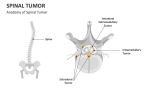 Anatomy of Spinal Tumor - Slide 4