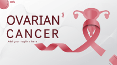 Ovarian Cancer - Slide 1