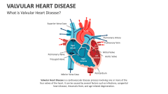 What is Valvular Heart Disease? - Slide 1