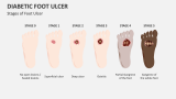 Stages of Foot Ulcer - Slide 5