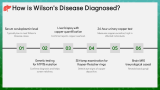Wilson's Disease - Slide 6