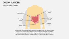 Colon Cancer - Slide 1
