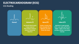 Electrocardiogram (ECG) PowerPoint and Google Slides Template - PPT Slides