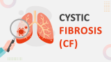 Cystic Fibrosis - Slide 1