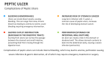 Complications of Peptic Ulcers - Slide 6