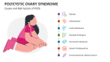Causes and Risk Factors of Polycystic Ovary Syndrome - Slide 6