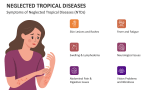 Symptoms of Neglected Tropical Diseases (NTDs) - Slide 5